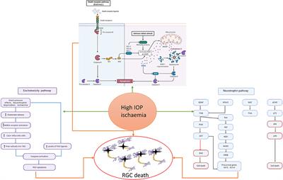 Transneuronal Degeneration in the Brain During Glaucoma
